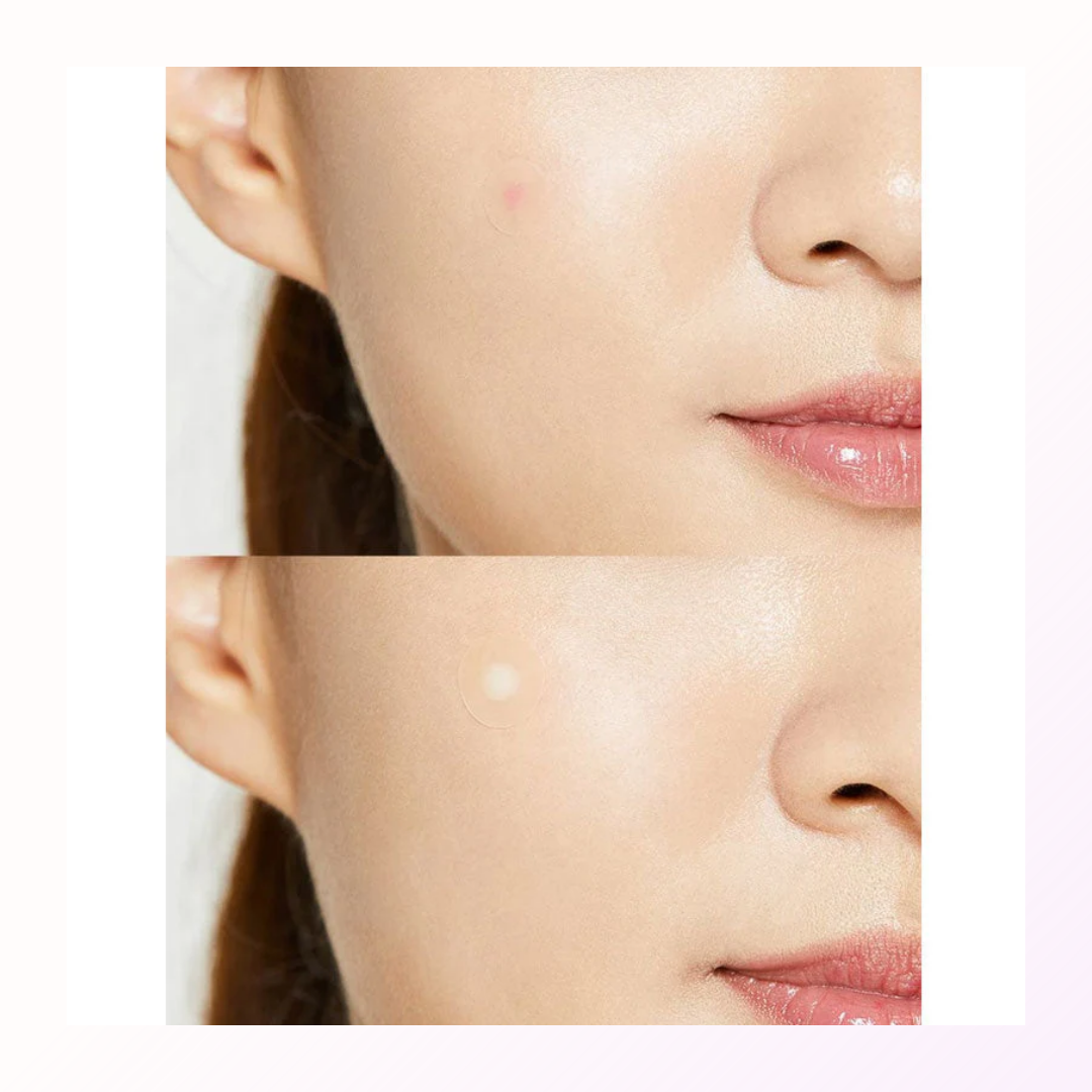 COSRX-Acne Pimple Master Patch