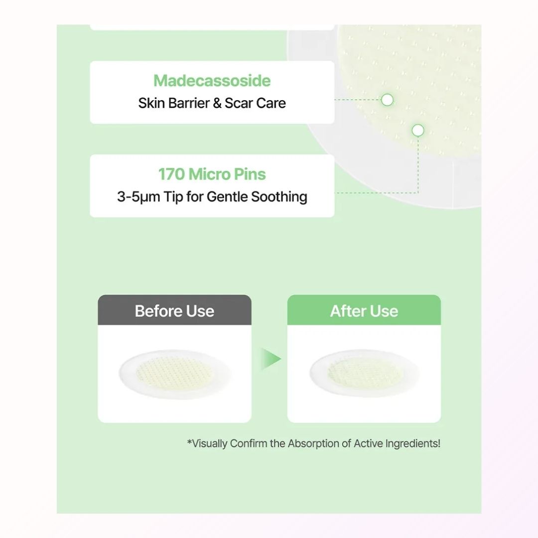 ONGREDIENTS – AC Balancing PDRN Shot Patch (9 Patches)